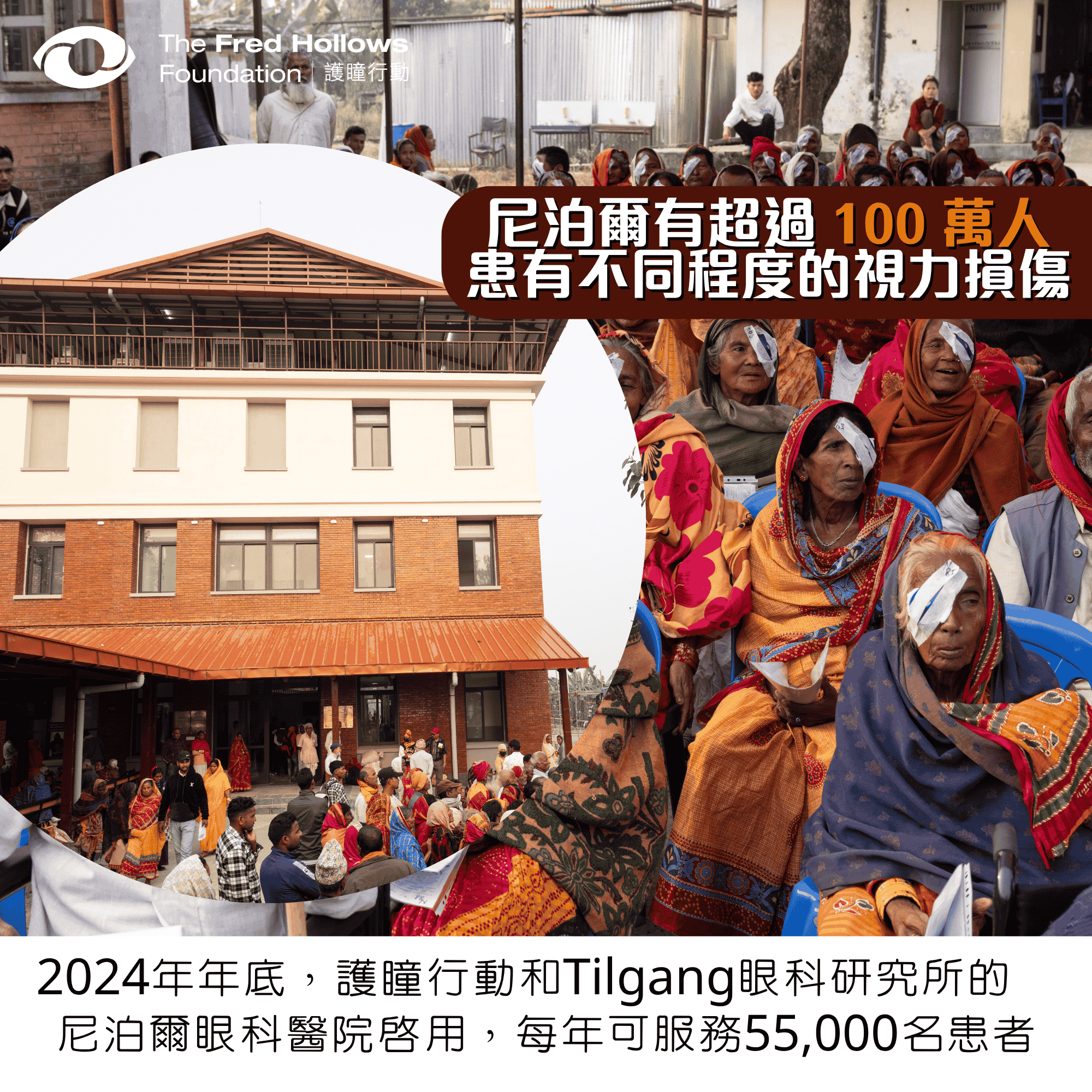Nepal_eye_hospital_fredhollows_TC