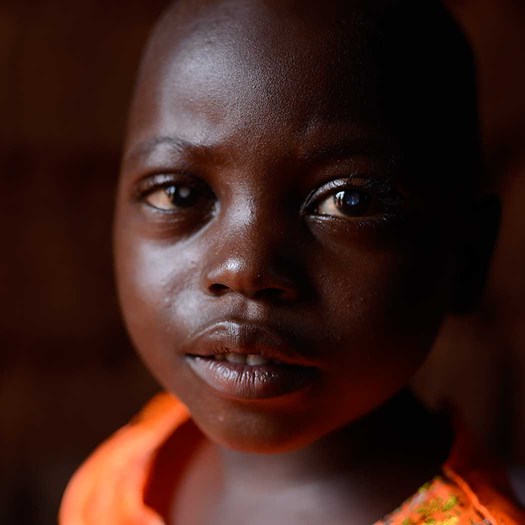 Trachoma disease - causes & treatment - Fred Hollows