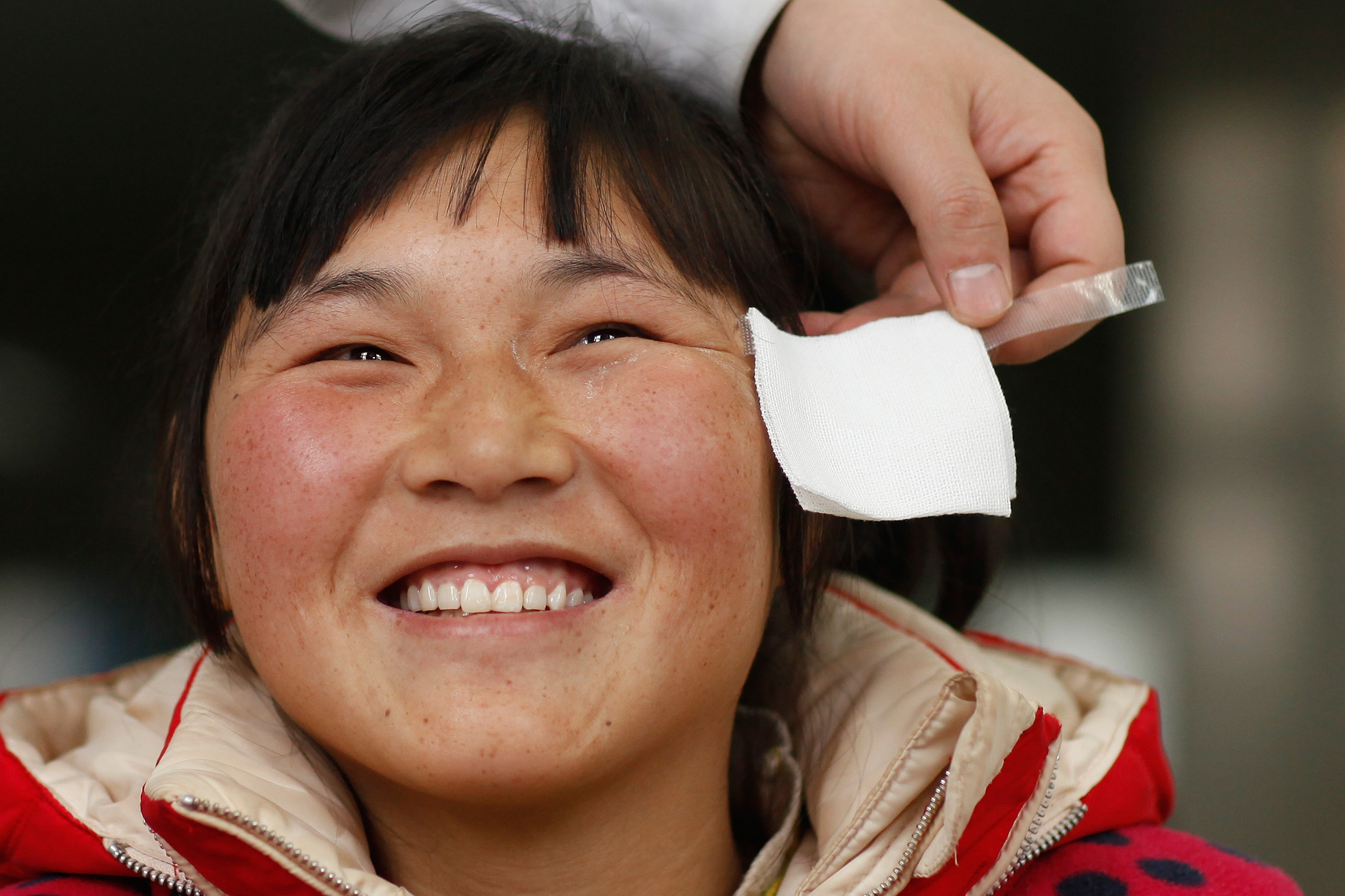 Mao Ni smiles as her eye patch is taken off after cataract surgery.