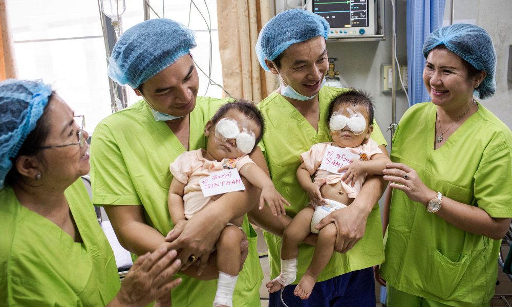 Twins after eye surgery in Laos