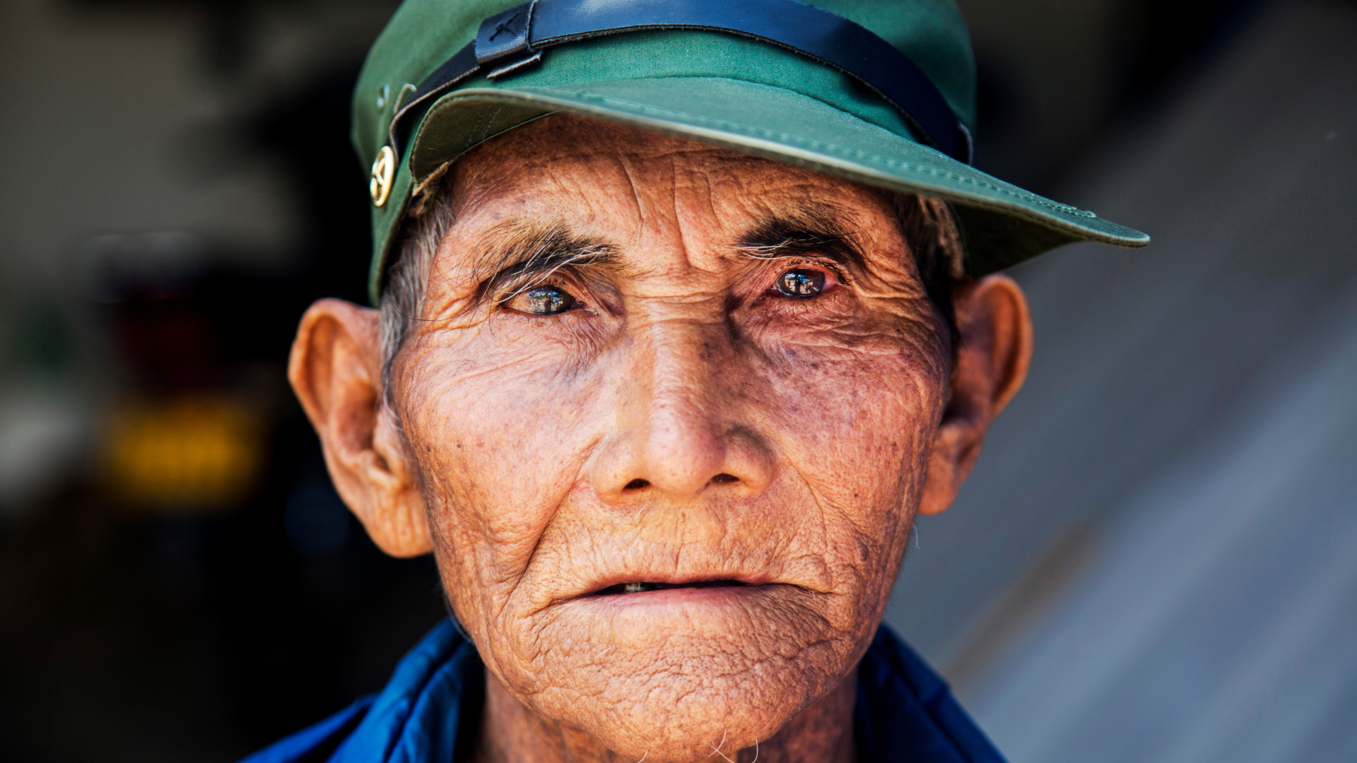 A Chinese man with cataracts looking into the camera 