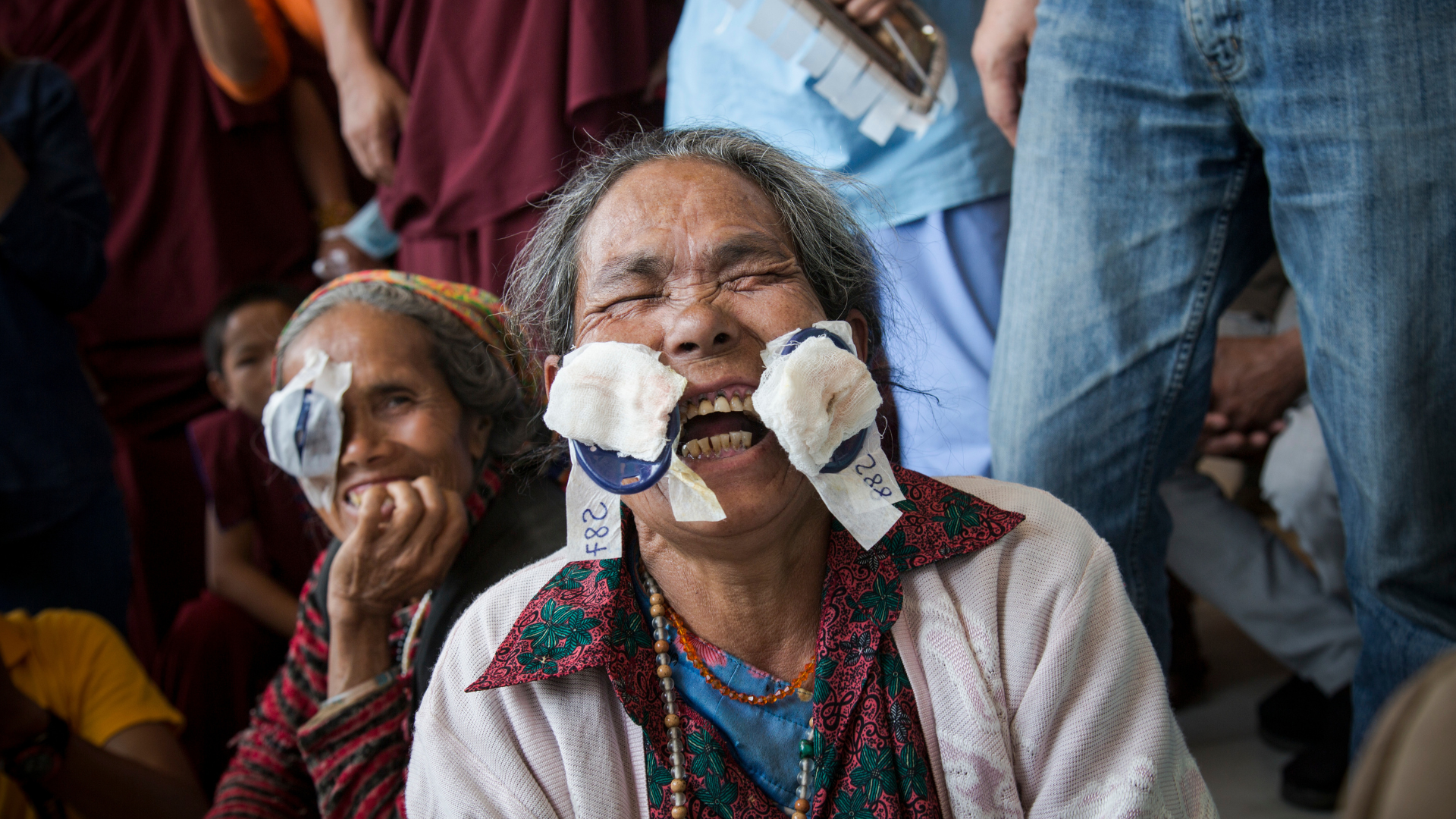 A woman from Nepal laughing and smiling as she gets her eye patch off