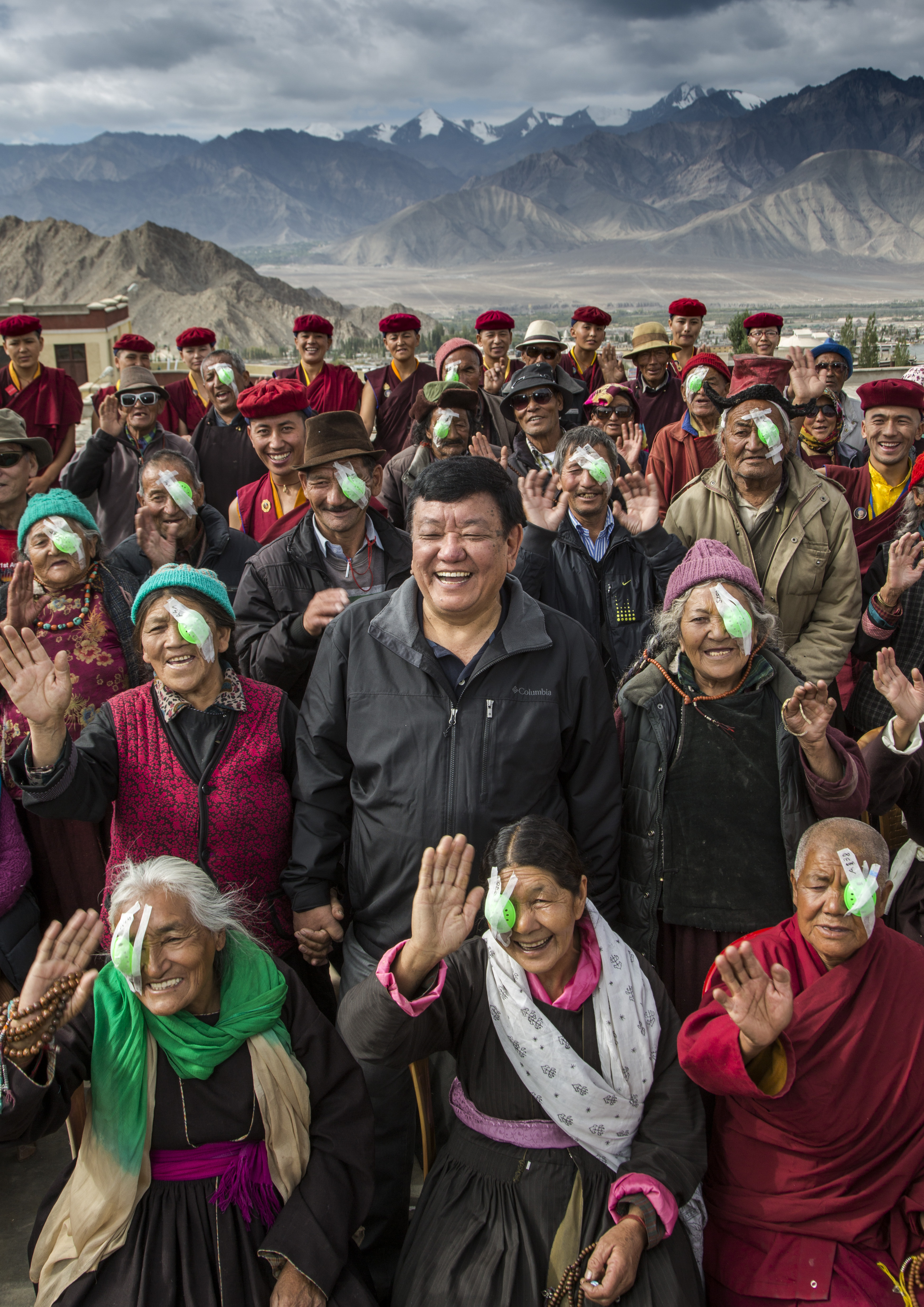 Pictured: Dr. Sanduk Ruit surrounded by his surgical patients just after their post-operative examinations. Picture taken by Michael Amendolia in 2016.