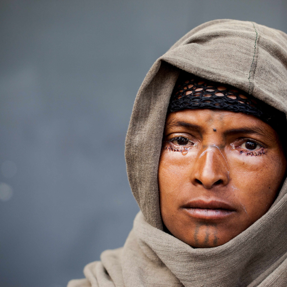 Ethiopia-2014_trachoma_960x960px.png