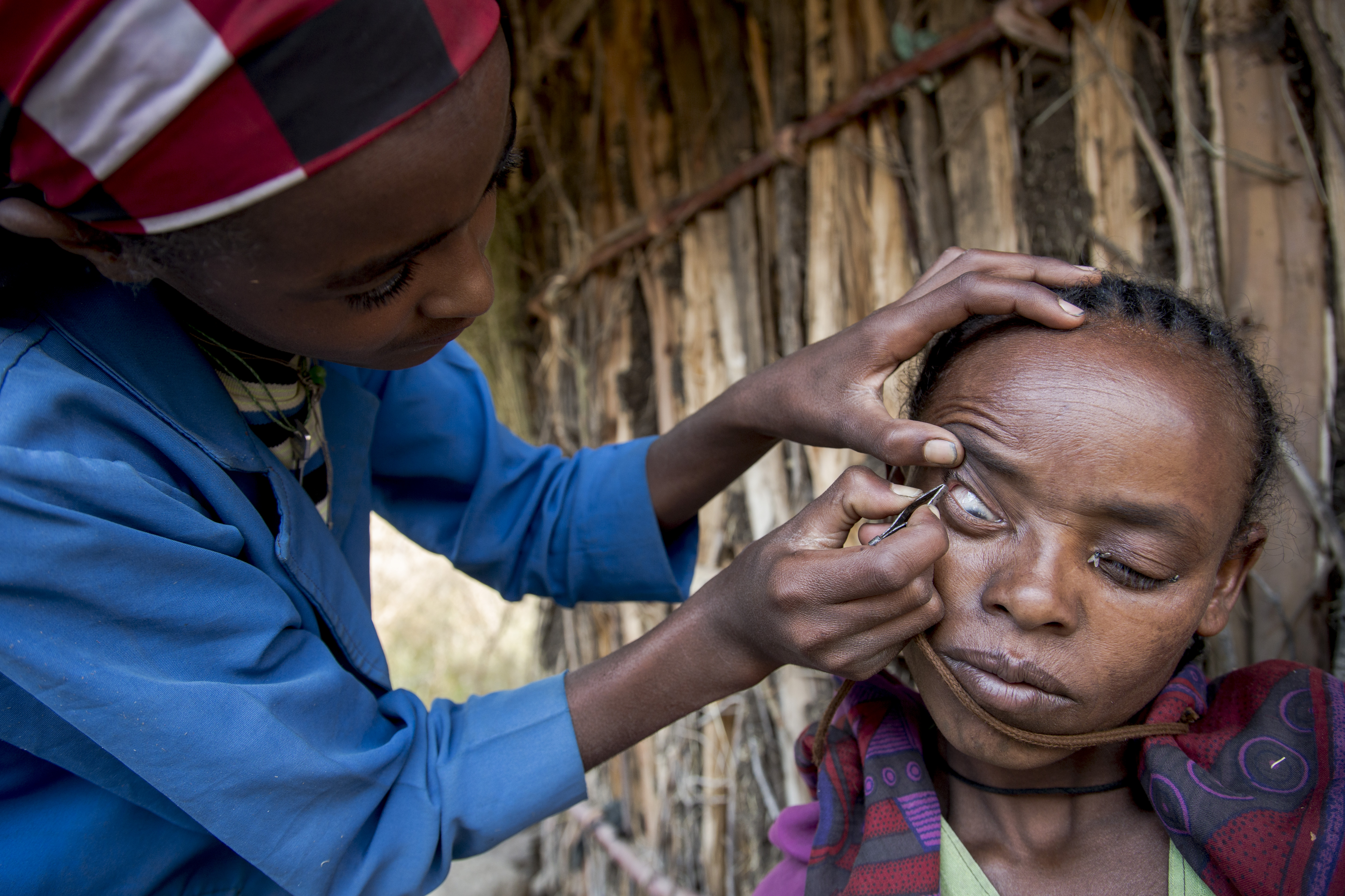 Shashetu getting her eyelashes plucked